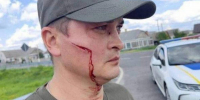Лопатой − по бандеровской морде: у брянцев появились неожиданные помощники - Газета Брянские новости